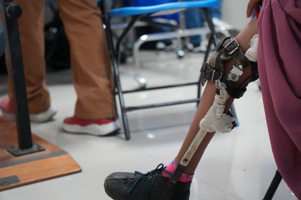 Realiza DIF Yucat&aacute;n jornada de valoraciones de pr&oacute;tesis y &oacute;rtesis, en Ticul