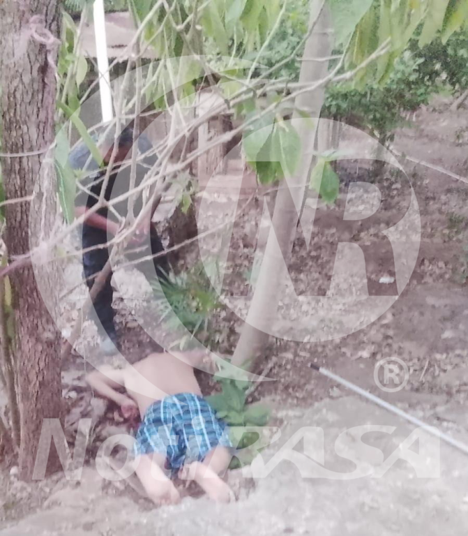 Cae adulto mayor y permanece horas lesionado, en Espita