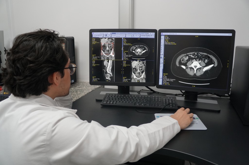 Adquirió IMSS Yucatán dos nuevos tomógrafos de alta gama