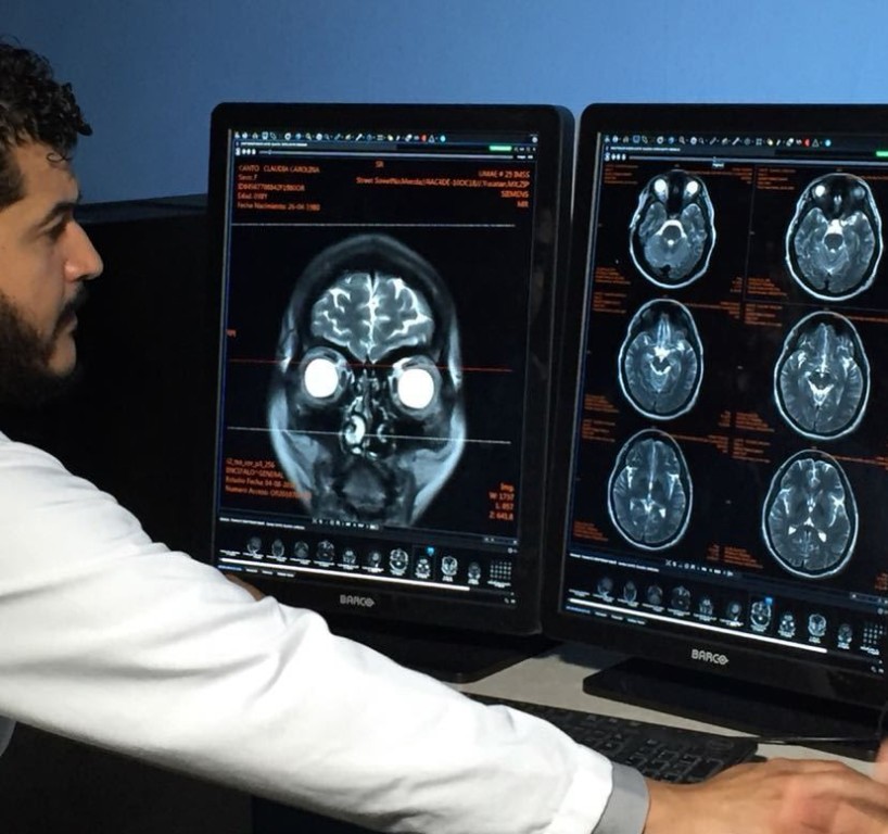 Ratifica IMSS Yucat&aacute;n atenci&oacute;n diagn&oacute;stica y mejora tiempo de respuesta con C&oacute;digo Cerebro