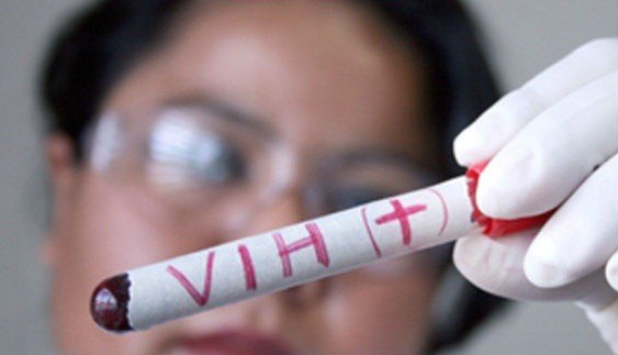 Por padecer VIH no le dan empleo