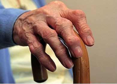 12 de octubre Día Mundial de la Lucha contra la Artritis