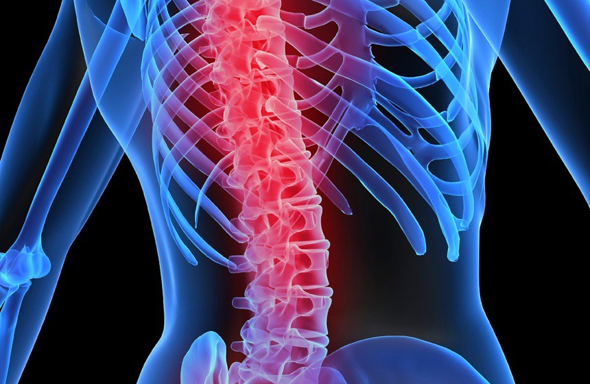 La osteoporosis se puede prevenir afirma el IMSS