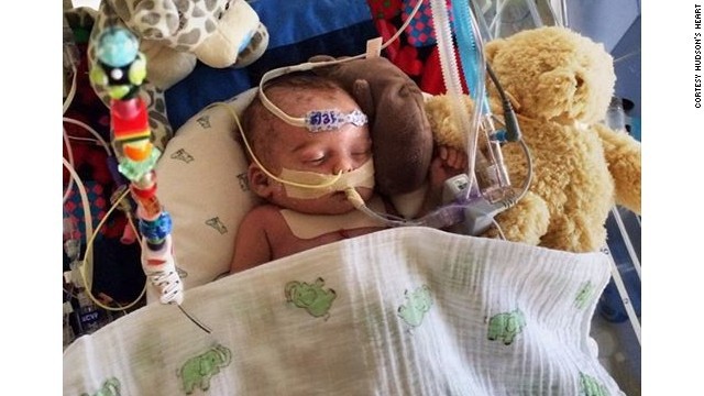 Facebook se rehusa a ayudar a un bebé enfermo por imagen "muy gráfica"