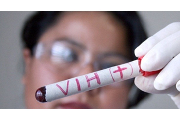 Realizaran foro sobre VIH-sida en Yucatán