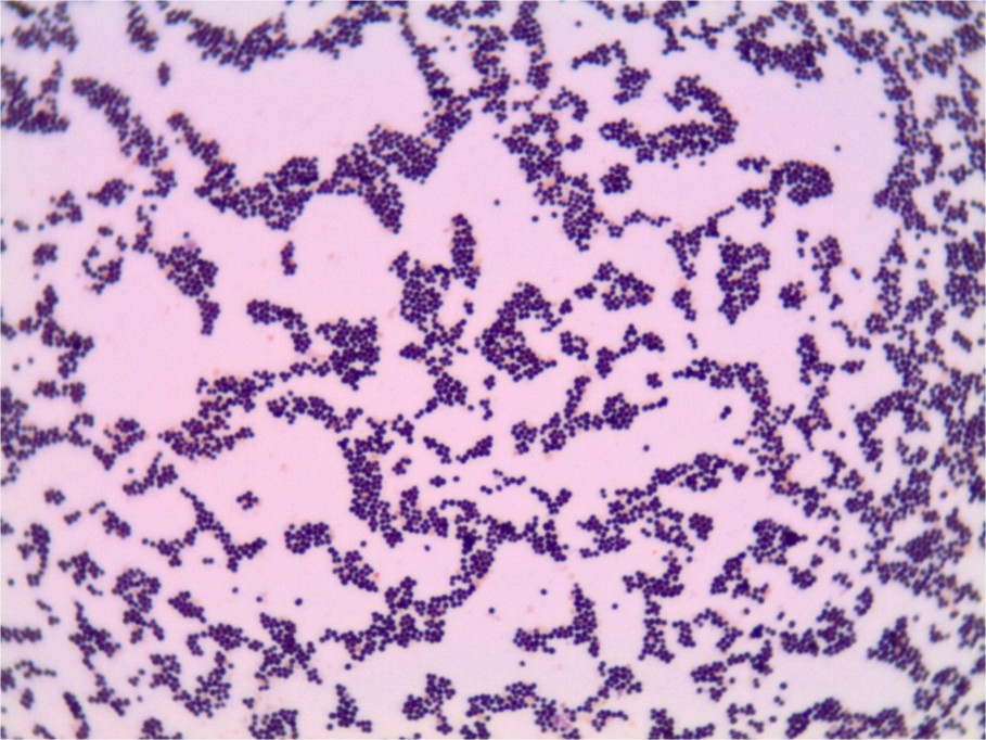 Familia campechana pudo contraer Staphilococcus aurius