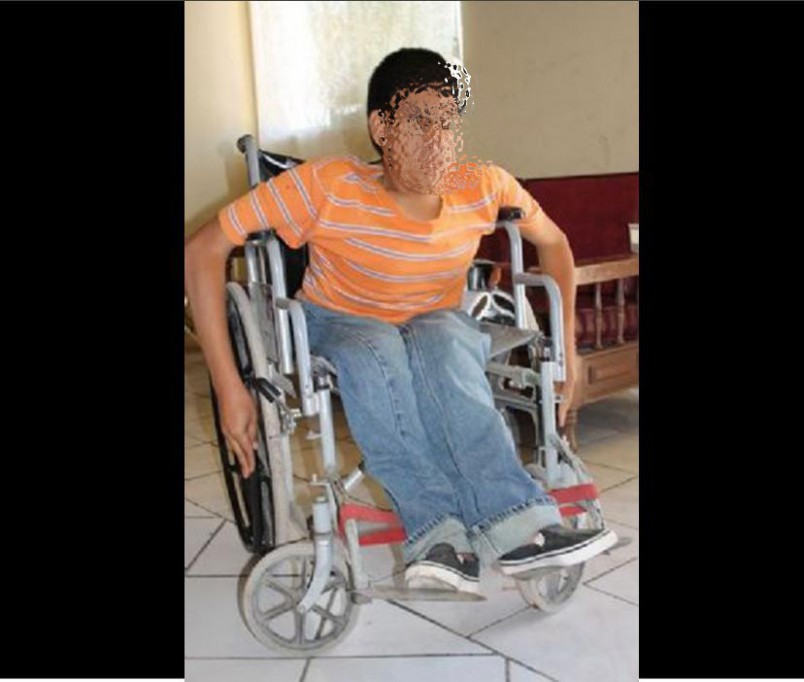 Joven con discapacidad pide ayuda para su operación