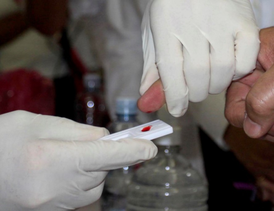 Alerta el número de jóvenes con VIH en Yucatán
