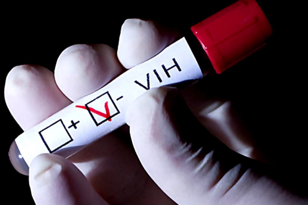 Hay más de 2 mil casos de VIH hay en Yucatán