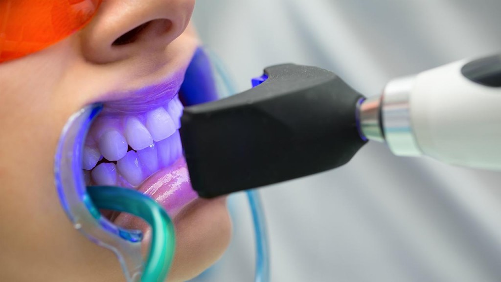 Aumenta la demanda del blanqueamiento dental