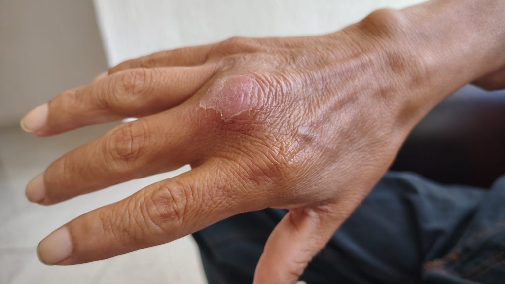 Requiere apoyo tizimileño para estudios médicos