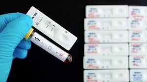 Fundación BAI retoma sus jornadas nocturnas para la detección del VIH Fundación BAI retoma sus jornadas nocturnas para la detección del VIH