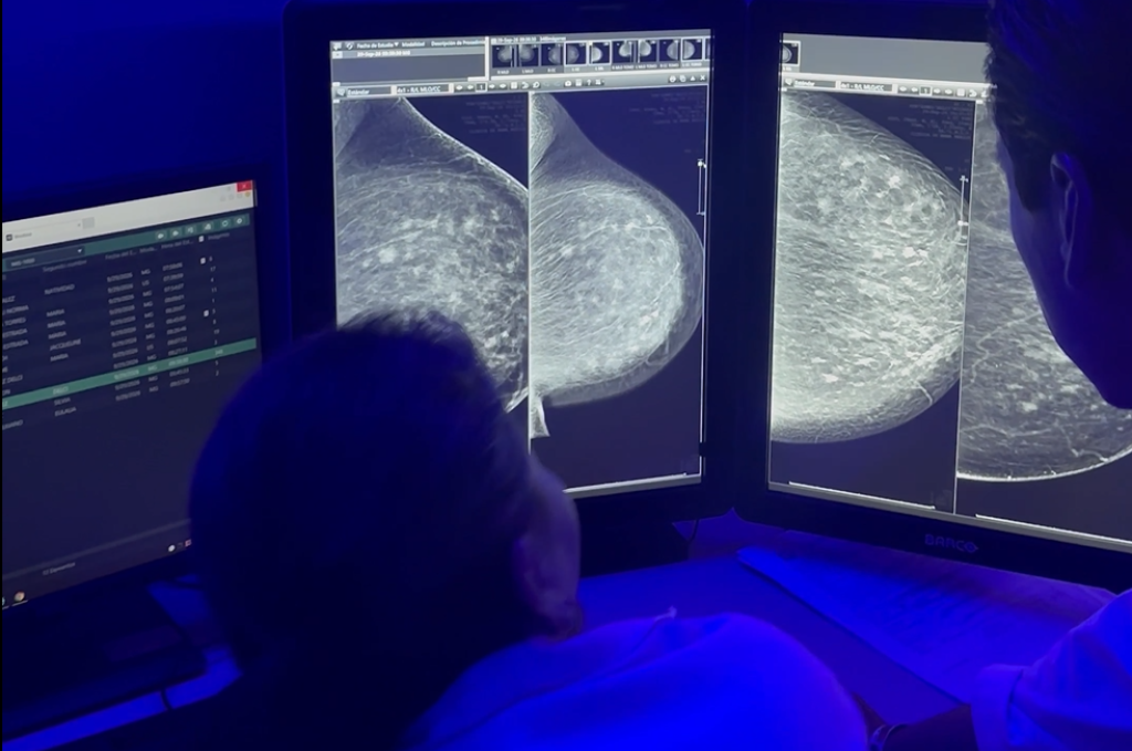 Tratamiento rápido, humano y con tecnología de punta: así opera la Unidad de Cáncer de Mama del IMSS Yucatán
